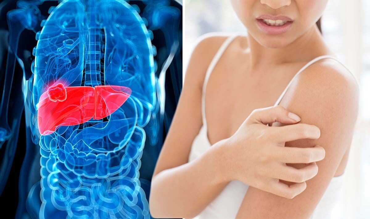 Shocking Revelation: The Silent Symptom That Could Signal Deadly Liver Cancer